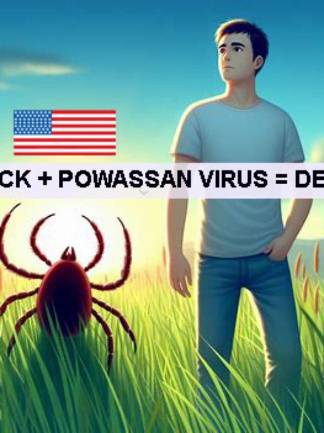 1st Case of Death Due to Powassan Virus Has Been Reported in Maryland (US)